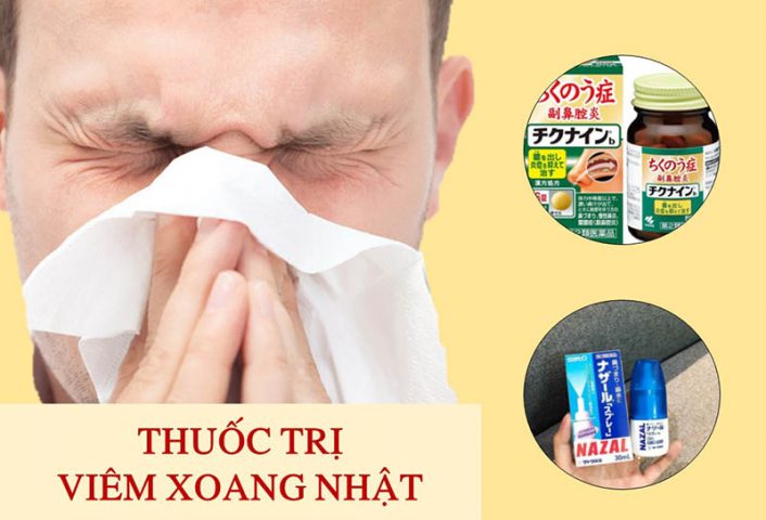 TOP 8 thuốc viêm xoang Nhật tốt nhất hiện nay và lưu ý khi dùng