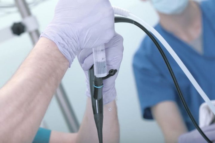 Nội soi bàng quang có tên gọi tiếng Anh là Cystoscopy.