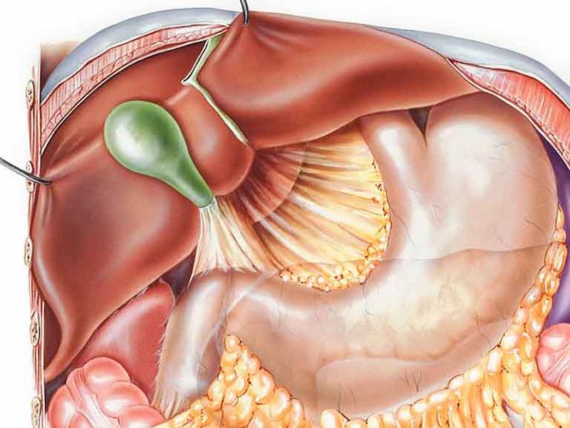 Chế độ ăn uống không khoa học là nguyên nhân gây trào ngược dịch mật