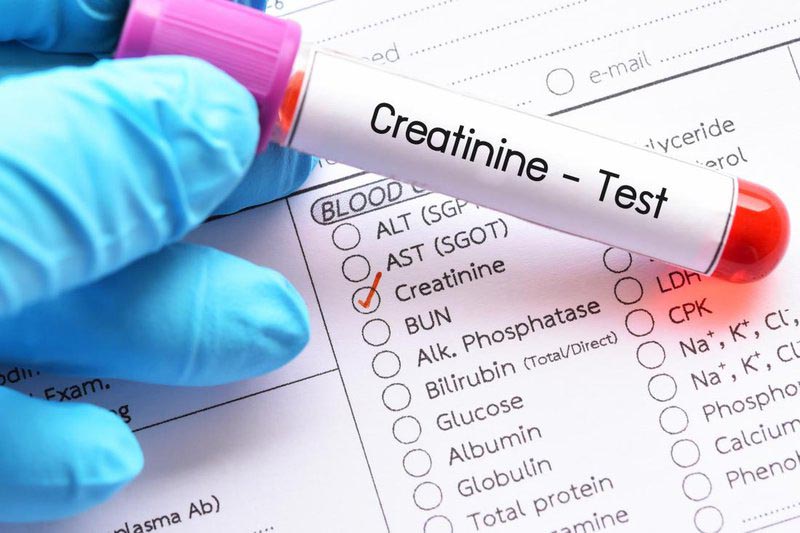 Kiểm tra creatinine để làm gì?