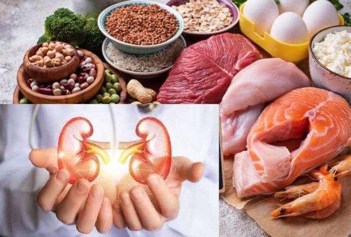 Chạy thận nên ăn gì? Bổ sung đủ lượng protein cần thiết