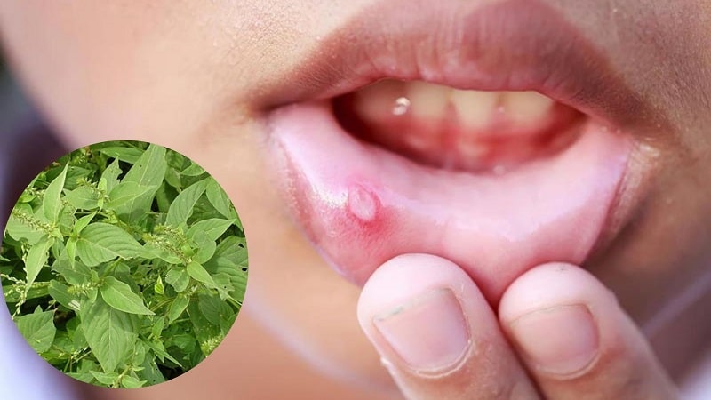 Loại thảo dược này còn chữa lở loét, nhiệt miệng