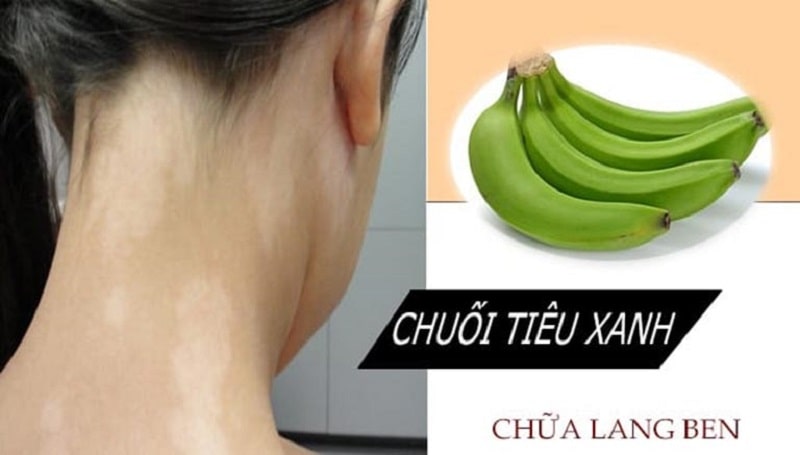 Chuối xanh có trị bệnh tại nhà an toàn, đơn giản