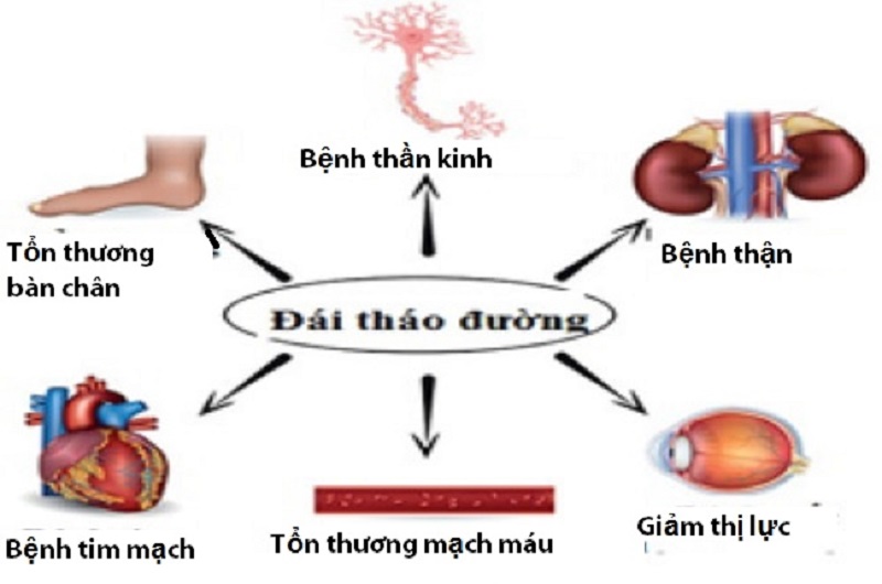 Bệnh đái tháo đường tuýp 3 đều có các triệu chứng giống như tiểu đường tuýp 1 và 2