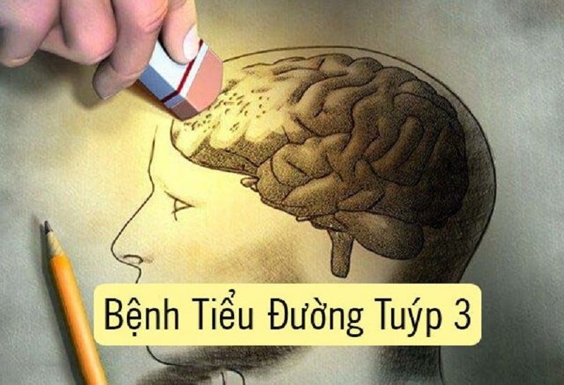 Bệnh tiểu đường tuýp 3 thực sự còn khá mới lạ đối với nhiều người