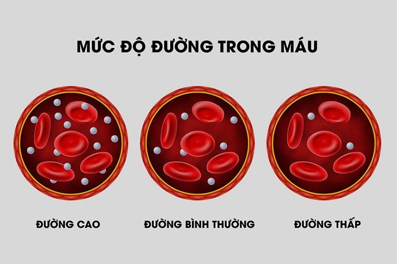 3 mức độ của chỉ số đường huyết