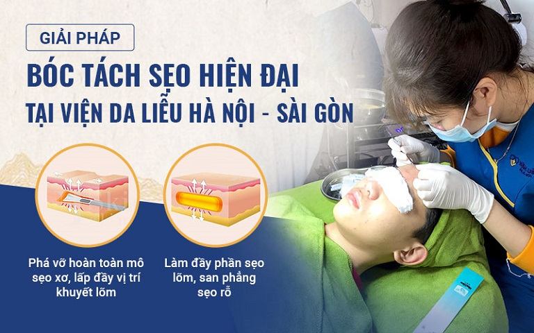 Phương pháp bóc tách chân sẹo tại Viện Da liễu được nhiều chuyên gia đánh giá cao 