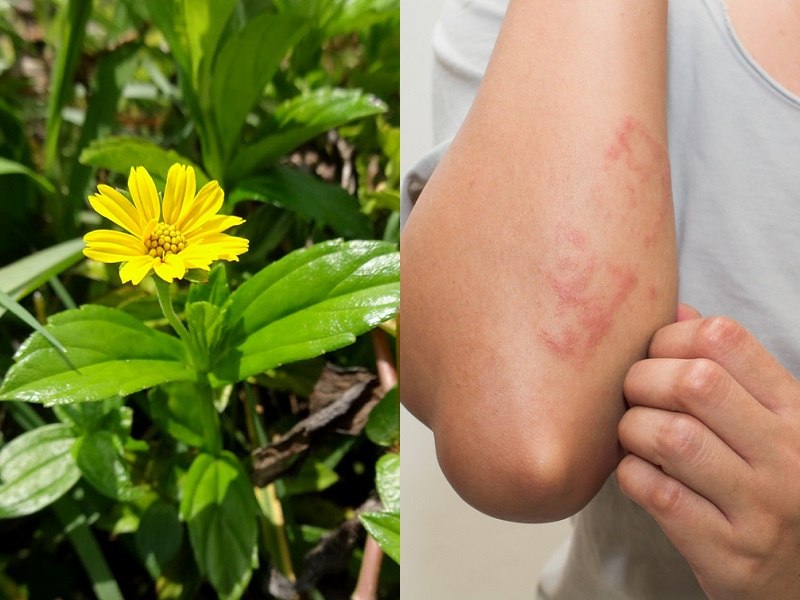 Khi bị mẩn ngứa bạn có thể sử dụng sài đất để cải thiện triệu chứng