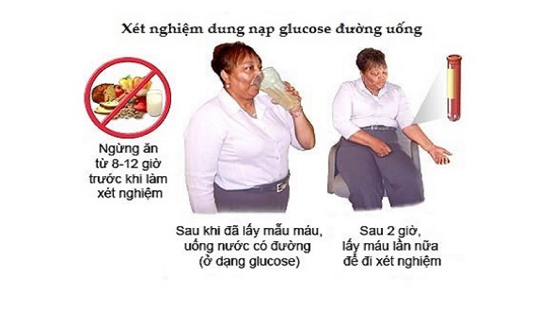 Các bước xét nghiệm dung nạp glucose