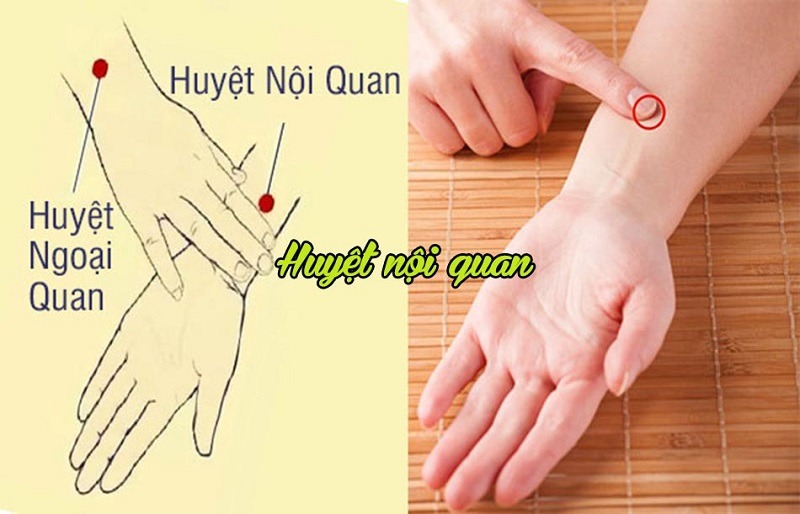 Huyệt nội quan là một huyệt đạo nằm trên cơ thể con người