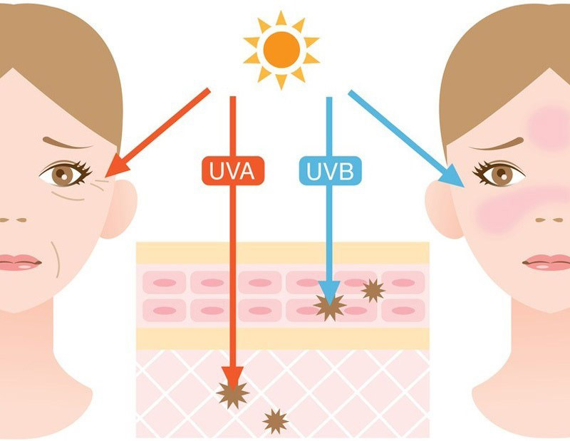 Nguyên nhân chính gây nám da là do tác động của ánh nắng mặt trời