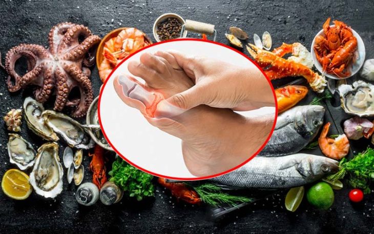 Ăn Nhiều Hải Sản Có Bị Gout Không? Cách Ăn An Toàn Sức Khỏe