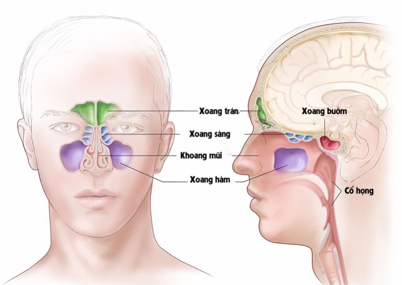 Viêm xoang sàng sau có thể gây nguy hiểm nếu không điều trị kịp thời